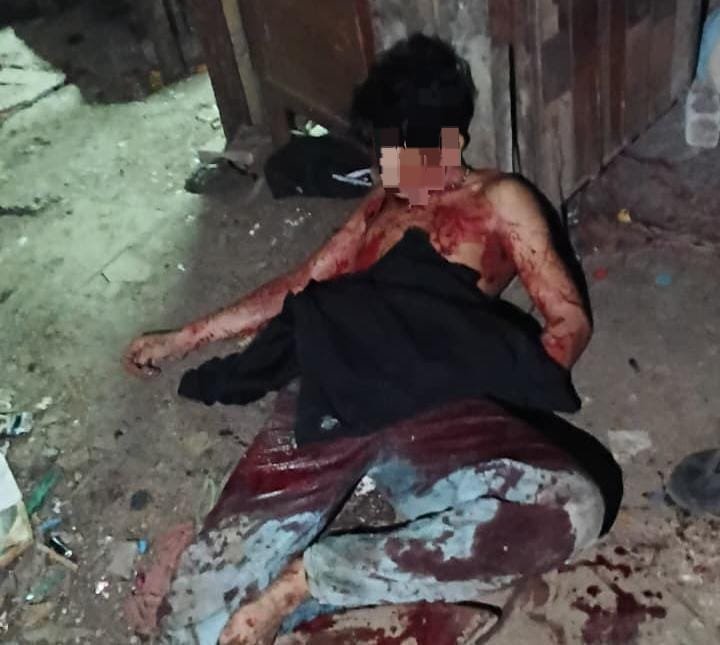 Di Duga Dipicu Salah Paham Saat Pesta Miras, Seorang Pemulung Tewas Ditikam Rekannya